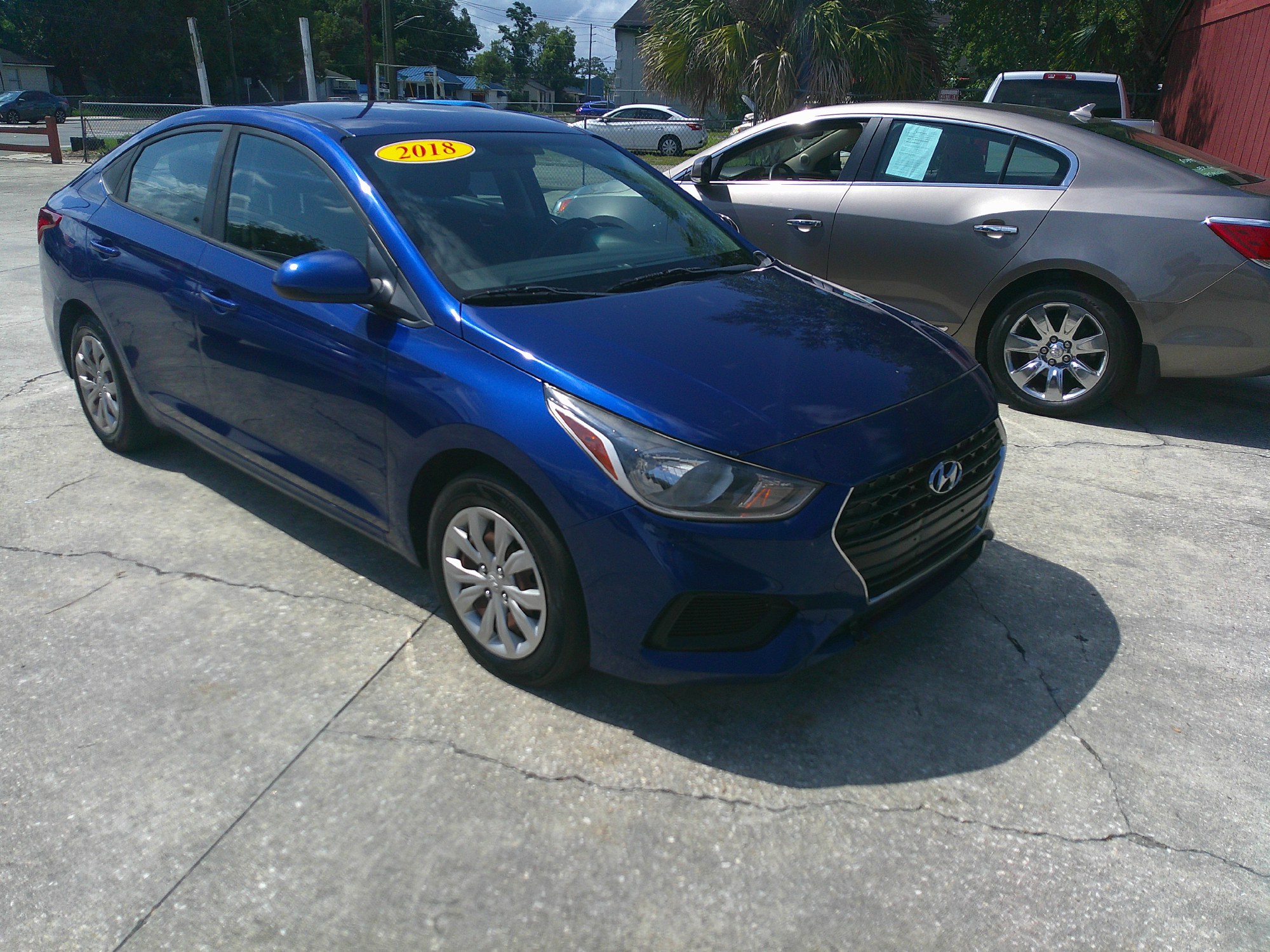 photo of 2018 HYUNDAI ACCENT SE; SEL 4 DOOR SEDAN